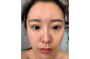 百幽草南京同仁堂美白祛斑霜去斑黃褐斑雀斑遺傳斑曬斑老年斑淡化斑點(diǎn) 1瓶裝【美白祛斑 針對各種斑點(diǎn)】 曬單實(shí)拍圖