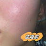 儒意軍訓曬后修復冰沙面霜女士保濕補水褪紅滋潤舒緩夏季干皮敏感肌 【修護褪紅舒緩】面霜80g 曬單實拍圖