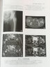 體部磁共振成像 復旦大學(xué)出版社 周康榮 著(zhù) 書(shū)籍 曬單實(shí)拍圖