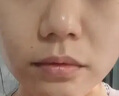 黑科技無創(chuàng)洗眉機祛斑便攜式美容儀大功率皮秒儀器洗紋身專用激光 高配皮秒六頭帶蜂巢頭 曬單實拍圖