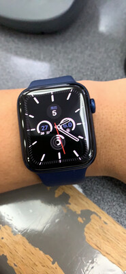 反馈Apple Watch Series 6怎么样？网友讨论