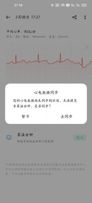 真实曝光 OPPO Watch怎么样？一个月后感受揭秘！