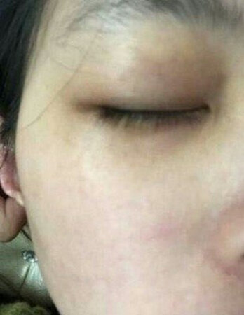 淡纹能力：眼霜真心不错，之前的眼袋和脂肪粒都没了，非常满意
