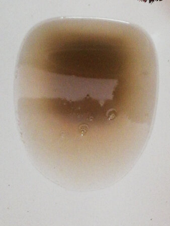 早上出门前把一整瓶倒进厕所里，没有用热水溶解，中午才想起问客服，客服说我的操作不对，回来后加入了热水，里面的污垢溶解好多。等到晚上就都溶解掉了。产品还是很管用的，尤其是坐便用久了，很容易堵塞。缺点是包装盒是没有明确的使用说明。我是一次倒进一瓶，效果明显。