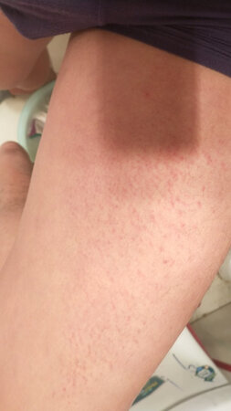 穿了两天  就有这个了  而且  裤子有股味道 我每天都洗澡