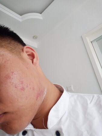 一点都不好用毛孔没有什么变化，而且脸上出油也多了，还过敏。