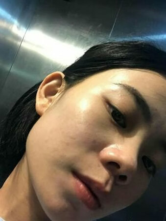 又回购了，这款面膜真心好用，补水不是一般的好，根据个人痘痘症状调配的药液，效果也真心好。三个疗程就好得差不多了，开心，