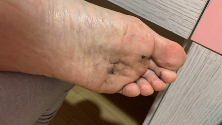 史上最差袜子，掉毛