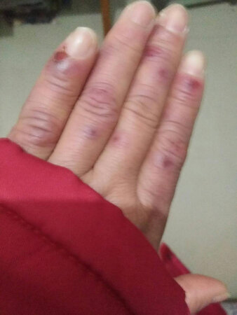 效果很不错哦,下次用完再来购买。收货到现在，每晚睡前擦,擦上很滋润,不到三四天就已经明显好转。吸收很快,价格实在。每到秋季开始一直到冬天,手脚都会干燥开裂,又红又肿，各种护手霜冻疮膏都用过，感觉还是这款的效果好，裂开都没之前那么夸张了，应该是在慢慢愈合，太好了。好不好真的需要自己使用才知道，我已推荐给我姐姐们买了。