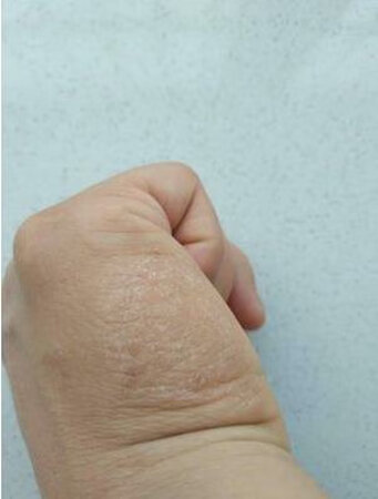 这个药膏便宜又好用，我用这个擦手足癣有很好的治疗效果，我才搽第一天过了10分钟左右就觉得涂抹的地方非常舒服，第二天又擦了一下基本就不痒了，脚下长的痒痒的水泡样的东西也在好转。