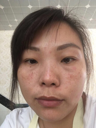 这个化妆品是假的吧用了脸都过敏了