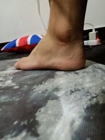 舒适度：说句良心话我这个人不挑剔网上买东西几乎从来不评价，但是这个我真的是忍无可忍了，从下单到发货到收到货，这个客服就跟死了一样，发的信息从来都是只看不回，你是他妈小学没毕业吗，鞋子收到放了三天没有穿，今天想起来了上班穿了一天，就今天一天，才一上午的功夫就觉得不舒服，到了下午直接磨脚磨得走路都别扭，晚上下班回家后鞋子一脱，果断起泡，不多#了，请看图，毕竟鞋子也不是很贵，但是重要的是你们的态度，想想我就气，客服从来不带说话的