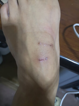 这袜子能穿吗，一穿就是一条伤痕，我就想说这种能穿吗！穿下去脚都要废了吧