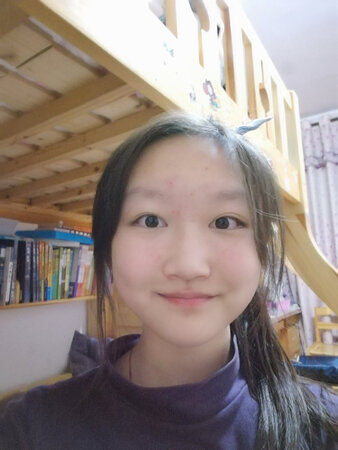 当时想的，如果凝胶不行就用这个，发现凝胶就已经消痘了，这个就没有用。