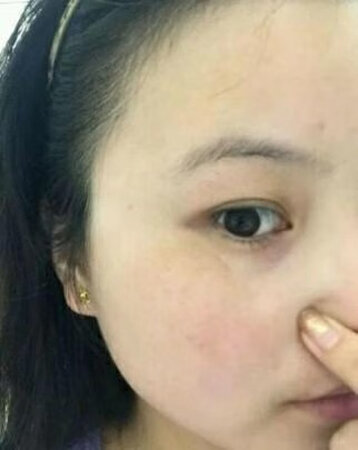用了之后美白淡斑效果挺好的，皮肤比以前变白了许多，同时也提高了亮度，而且这款产品味道也好闻，有着淡淡的清香味，最主要是水润保湿，持久性也很强，我其实是一个敏感性的皮肤，但是用了这款并没有发现什么过敏的地方！！现在脸上的斑用了这两个多疗程，已经去除的差不多了，很不错的产品，价格有也实惠
