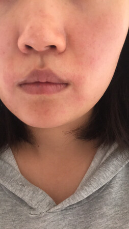 第一次在京东买粉底，过敏了……