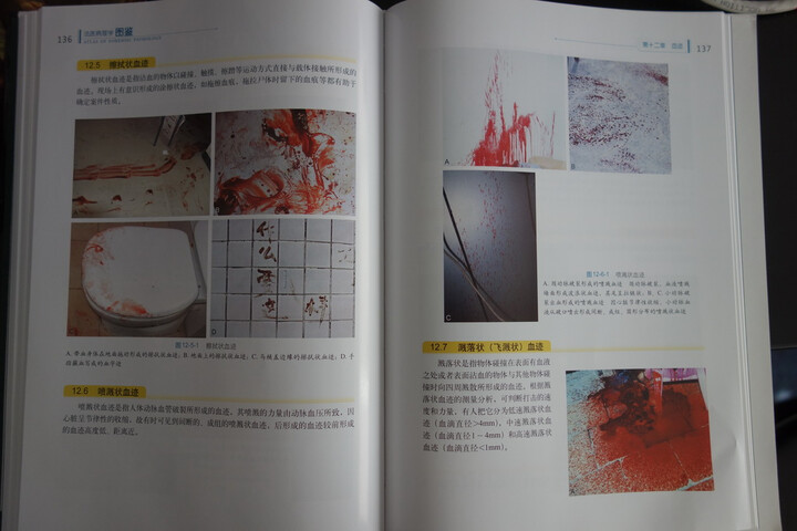 国家精品课程法医病理学配套图鉴:法医病理学