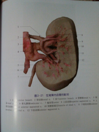 钟世镇临床解剖学图谱全集:泌尿外科临床解剖