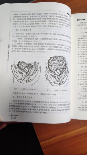 妇产科手术学 晒单图