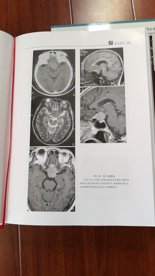 中枢神经系统CT和MR鉴别诊断 第3版 晒单图