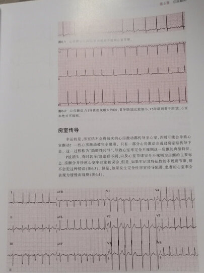 Bennett心律失常：临床解读和治疗实用指南（第8版） 晒单图