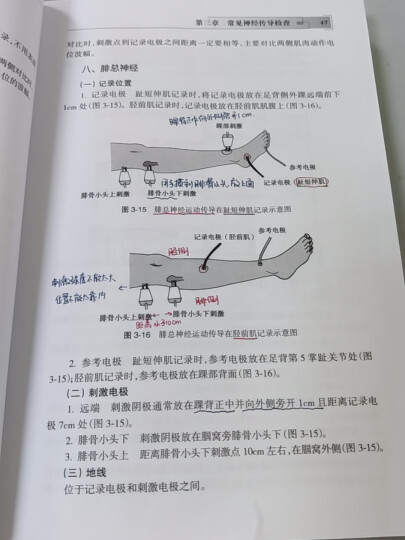 肌电图诊断与临床应用 (第2版) 晒单图