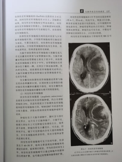 中枢神经系统CT和MR鉴别诊断 第3版 晒单图