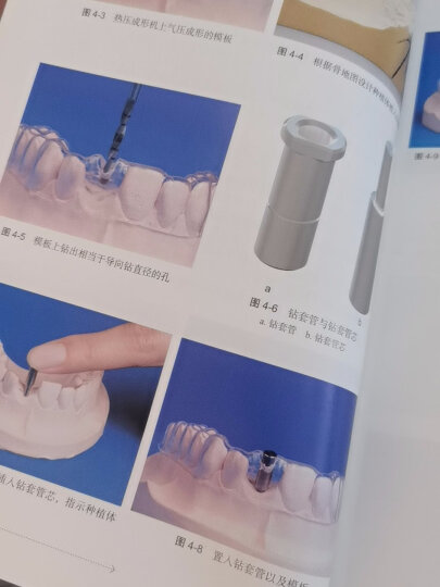 口腔临床操作技术丛书·口腔种植临床操作图解 晒单图