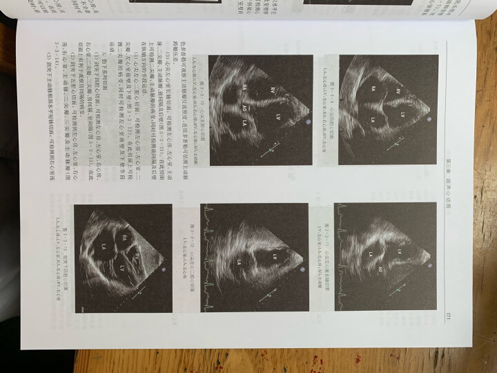 实用心脏病学（第五版） 晒单图