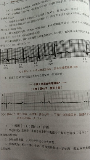 明明白白心电图（第4版） 晒单图