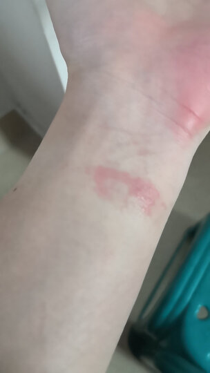 点喷完后皮肤过敏了手腕处竟然长疹了.不敢用了直接扔了.