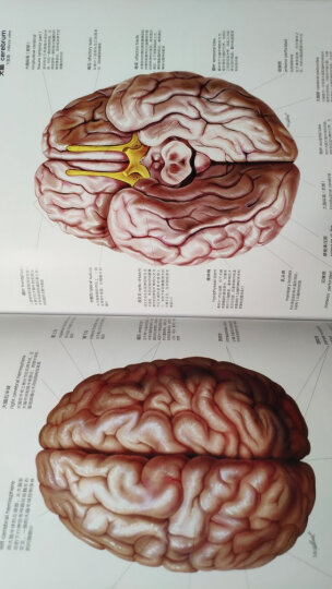 中枢神经系统磁共振成像（第3版）（上下卷） 晒单图