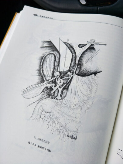 腹部外科手术学 晒单图