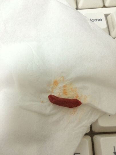 宁夏特产 宁安堡中宁枸杞250g--这枸杞有毒,掉