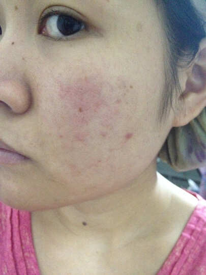 丹龙(DanLong)声波洁面仪D2脸部美容仪器 家