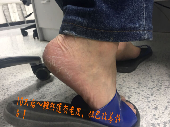 【官方授权】Baby Foot足膜脚膜 日本进口 天然果酸美足嫩肤去死皮老茧 男士专用(60分钟) 晒单图