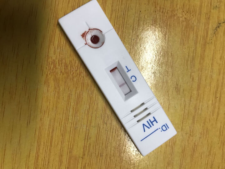 准信HIV检测试纸:这15分钟我是漫长的对待、