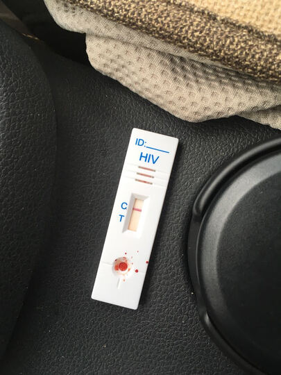 准信HIV检测试纸:高危一年多,一个月前去看病