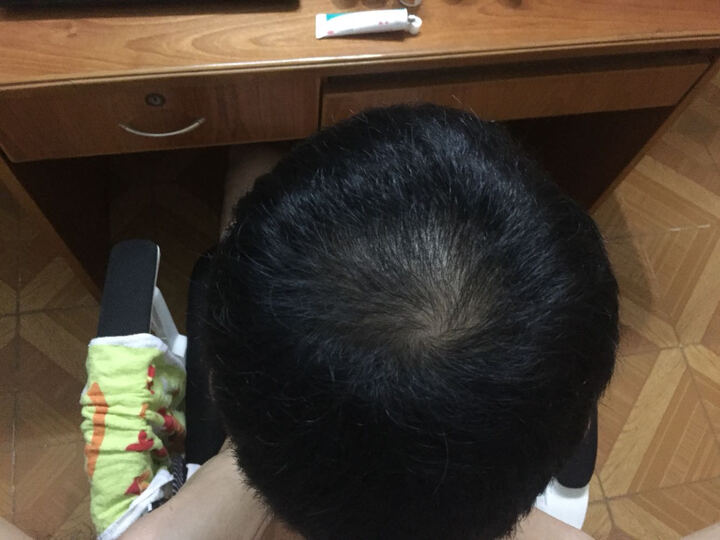 博士伦 米诺地尔凝胶 40g:0.88g(防脱发 治疗脱发 脂溢性脱发) 晒单图