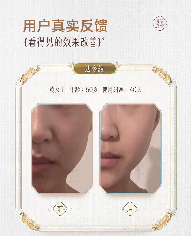 美颜笔记抗皱紧致面霜紧致抗皱提拉紧致法令纹抬头纹去除熬夜面霜