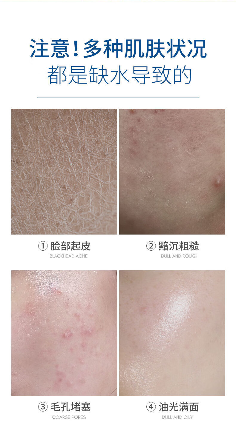 草萨（CaoSa）玻尿酸补水喷雾保湿控油清爽小分子柔肤水敏感肌舒缓化妆水150ml