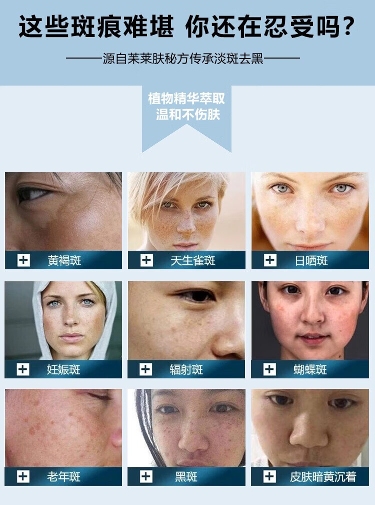 NHFOUYOU祛斑精华油点黑点玫瑰净颜精油补水美白提亮肤色溶斑精华美白淡斑 1瓶【体验装】