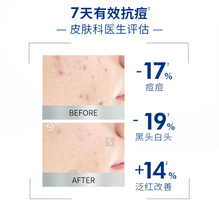 妮维雅男士洗面奶控油洁面乳 清洁抗痘保湿补水 控油细致毛孔洁面乳150g*2
