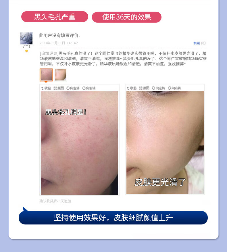 白云山 收缩毛孔面膜清洁祛痘黑粉刺头玻色因小气泡睡眠面膜200ml