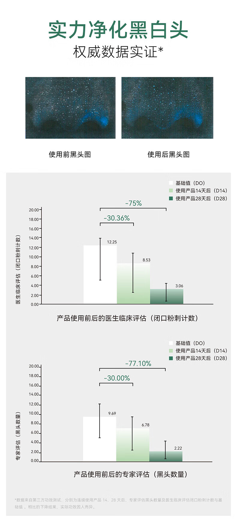 安修泽 清洁泥膜 水杨酸清洁面膜深层清洁毛孔去黑头涂抹式白泥易冲洗 30g
