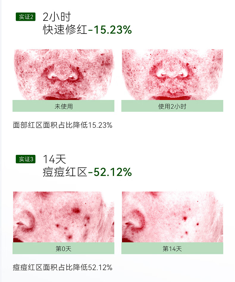 安修泽油橄榄精华 面部修护精华油液态修红舒缓呵护敏感 30ml滋润版（偏粘）