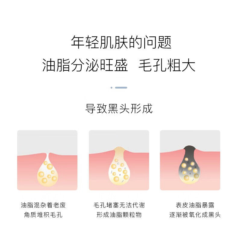 UNIO去黑头鼻贴免撕拉猪鼻头贴温和不刺激收缩毛孔闭口粉刺T区护理男女通用10片/盒
