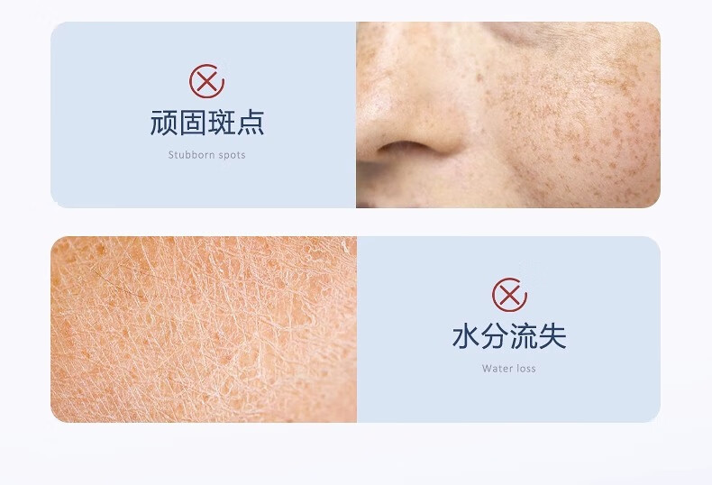 ORGINESE欧橘377熊果苷美白祛斑霜淡化色黄褐雀斑黑色素补水保湿50g礼物女