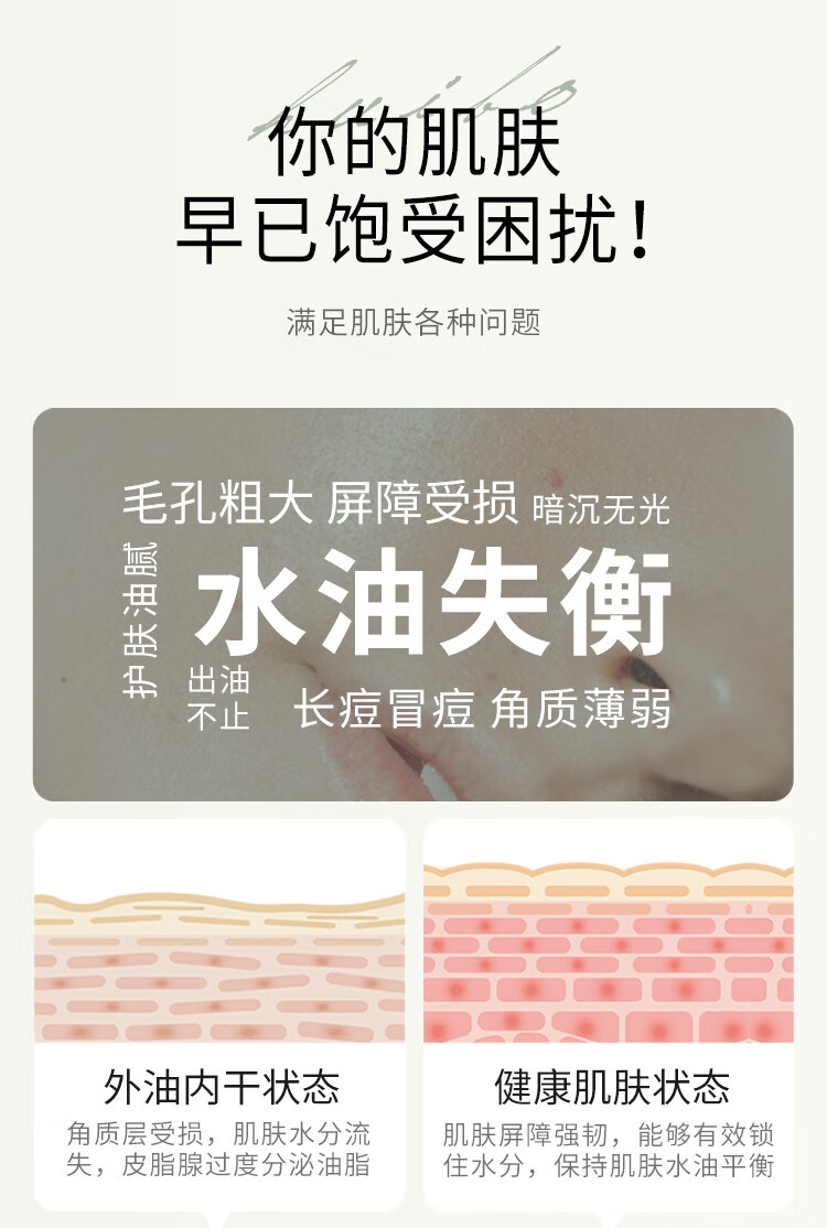 荟宝 芦荟胶优活祛淡化痘印补水保湿舒缓凝胶晒后修护面霜 抗黑头粉刺 【祛痘型】优活芦荟胶45g