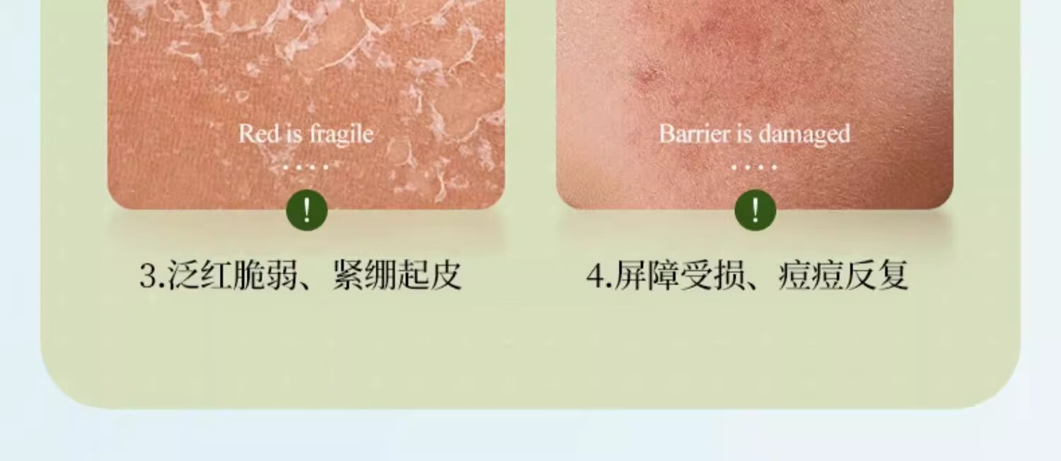 水木花草 积雪草熬夜水乳套装补水保湿控油男女护肤品套装学生收缩毛孔